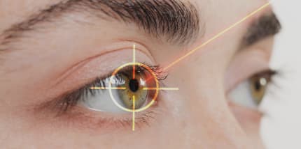 cataract surgery image