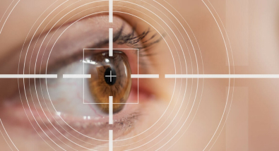 lasik surgery image