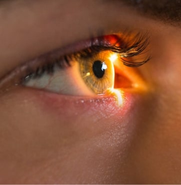 eye-disease