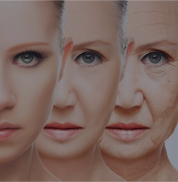 face-lift